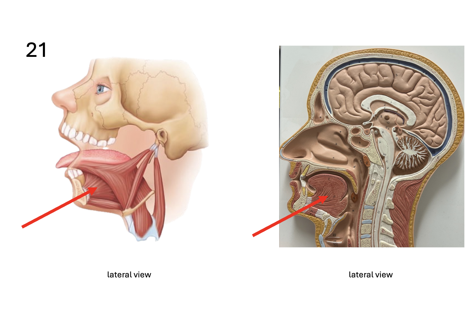 <p>Identify the <strong>muscle</strong></p>