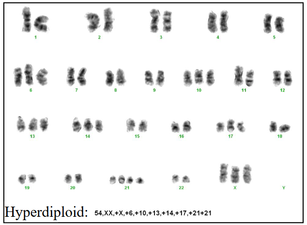<p>Chromosomes in ALL: prognosis</p>
