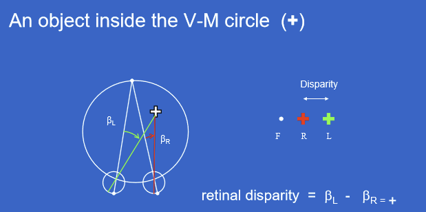 <p>An object inside the Vieth-Müller circle produces positive crossed retinal disparity. This means the left-eye and right-eye images are displaced in a crossed pattern relative to fixation.</p>