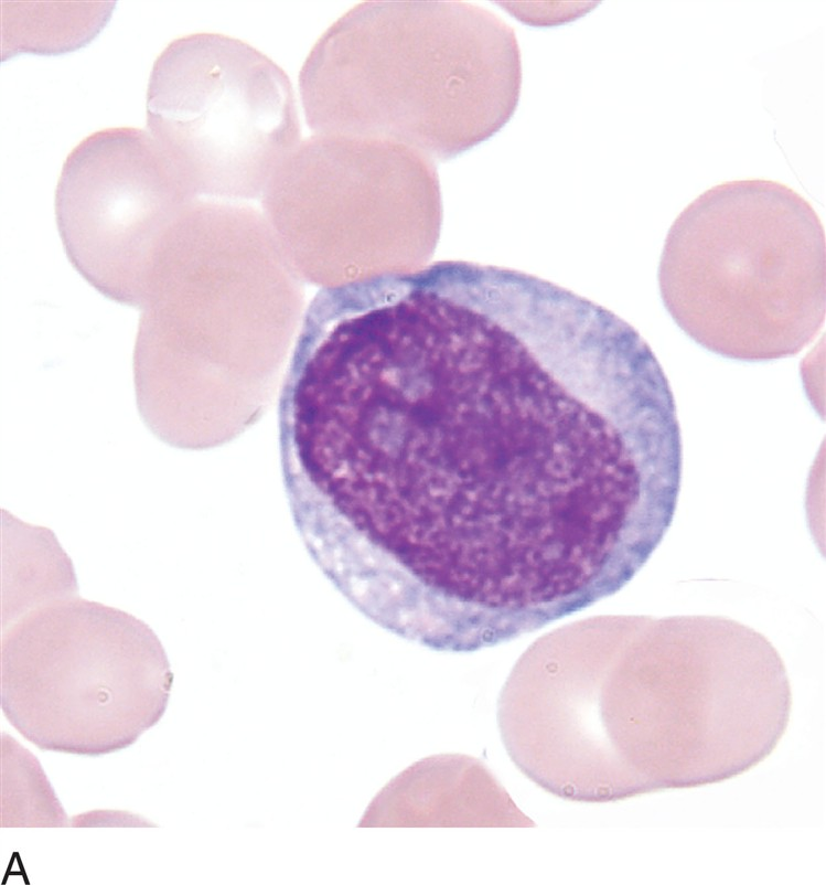 <p>what is a monoblast?</p>