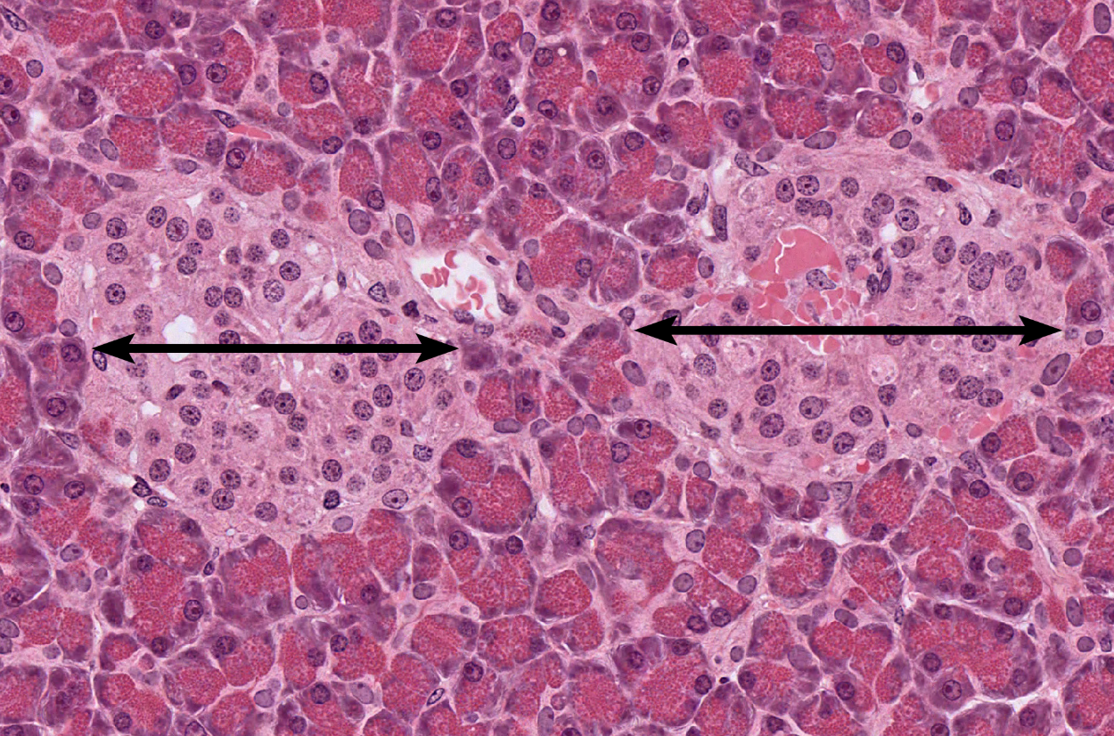 <p>Pancreas</p><p><strong>NOTICE: ISLET OF LANGERHANS WHICH ARE WHERE ENDOCRINE CELLS ALL PACKED TOGETHER</strong></p>