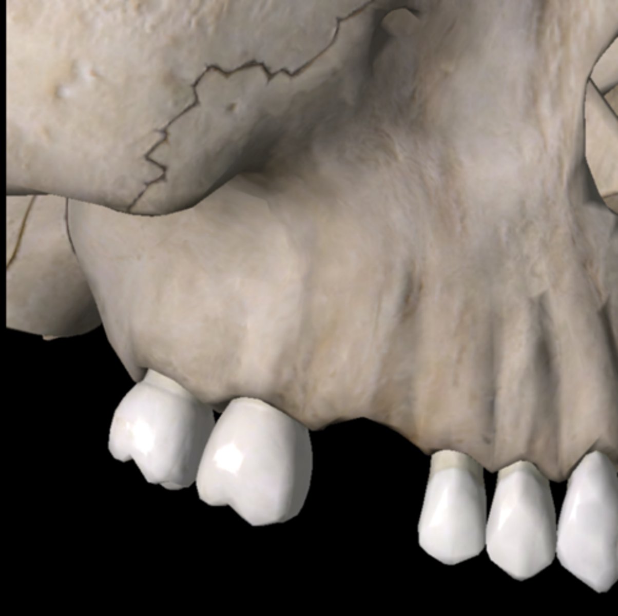 <p>What is the concern with replacing a molar? (Regarding it's size)</p>