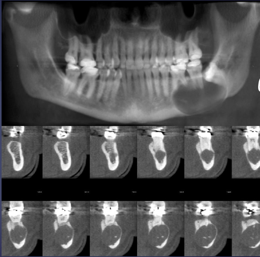<p>what is this and what phenomena can be seen in the lower row?</p>