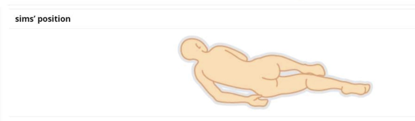 <p>a rectal examination </p>
