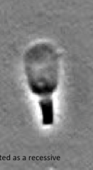 <p>Inherited as a recessive condition</p>