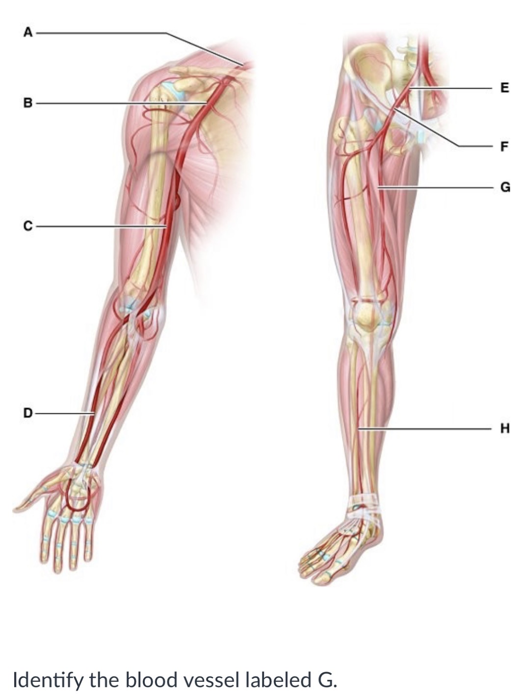 <p>Femoral artery</p><p>Internal iliac artery</p><p>External iliac artery</p><p>Anterior tibial artery</p>