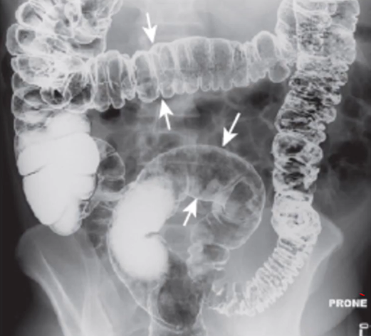 <p>Describe the radiograph</p>
