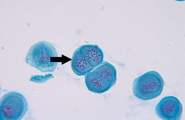 <p>Nuclear membrane breaks down, chromatin condenses, mitotic spindle forms and attaches to kinetochores</p>