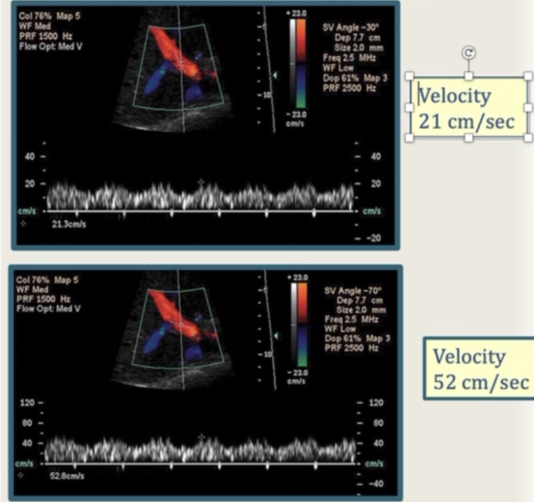 <p>Discuss the difference in velocities of these two images?</p>