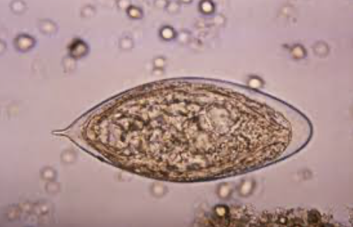 <p><strong>Zdjęcie <em>Schistosoma haematobium</em> do rozpoznania i opis</strong></p>