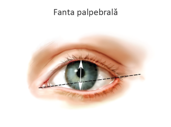 <p><span style="background-color: transparent;">Opening between the eyelids</span></p>