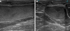 <p>What is this? (jugular vein)</p>
