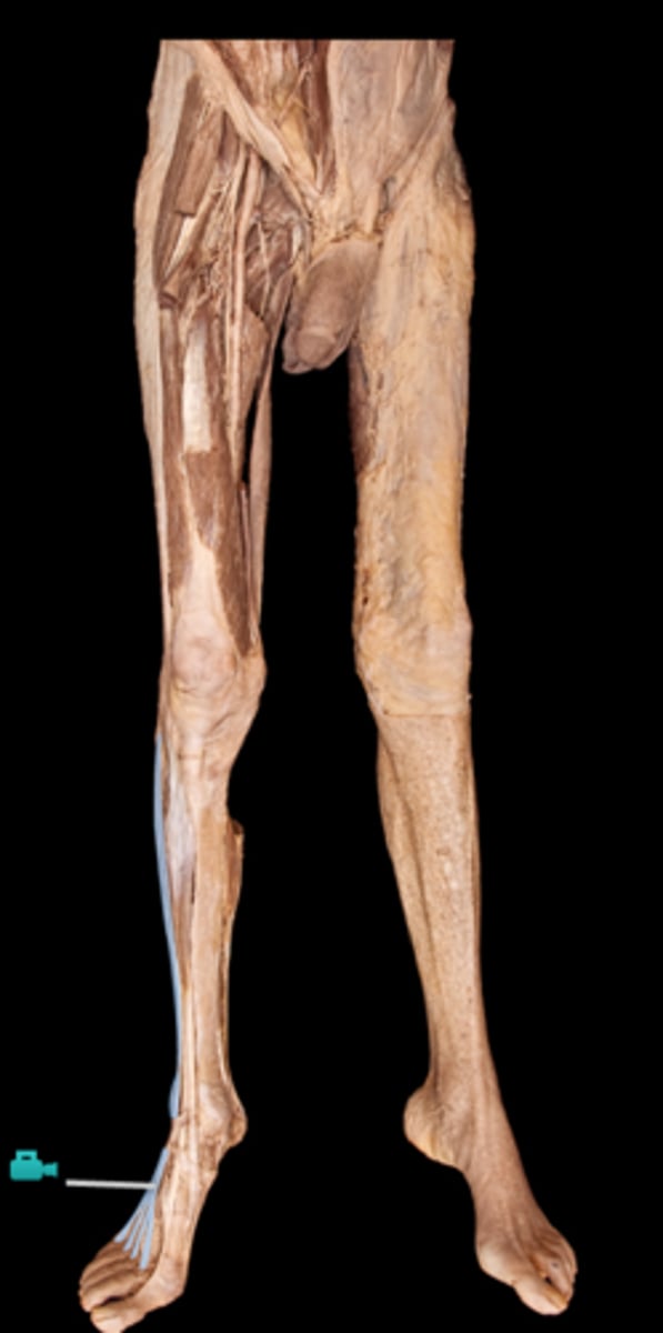 <p>What muscle is this?</p>