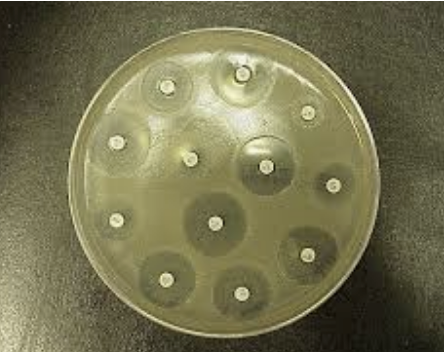 <p><span>how are bacteria classified in this test?</span></p>