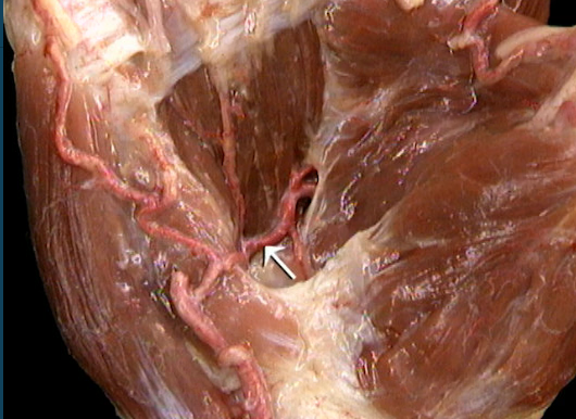 <p>Diep, handpalm</p>