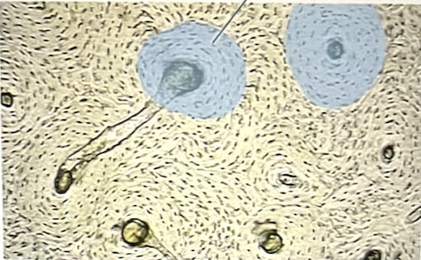 <p>identify the highlighted tissue in picture</p>