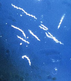 <p>Borrelia burgdorferi is what shape*</p>