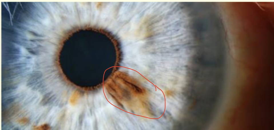 <p>Describe and give diagnosis </p>