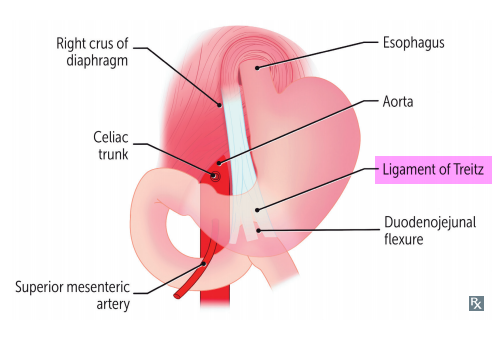 <p>Depends on if above or below the ligament of Treitz</p>