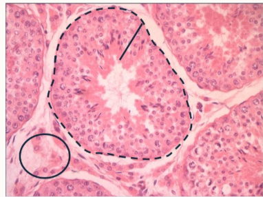 <p>Describe the histology visible here</p>