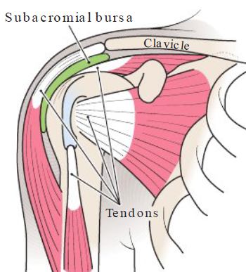 <p><strong>Definition</strong></p><ul><li><p>Inflammation of tendons in shoulder</p></li></ul><p></p><p><strong>Causes</strong></p><ul><li><p>Holding elbow above waist level and upper arms away from body</p></li></ul><p></p><p><strong>Symptoms</strong></p><ul><li><p>Pain and impaired function of shoulder joint</p></li></ul><p></p>