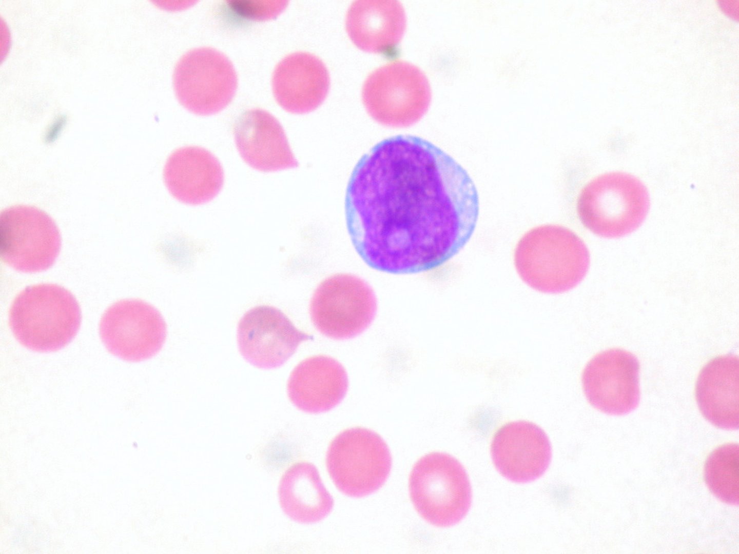 <p>immature bone marrow that gives rise to granulocytes</p>