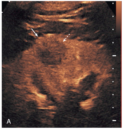 <p>Specific imaging modality used</p>