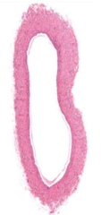 <p>Would this be an artery or vein?</p>