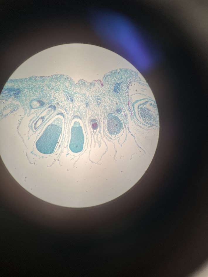 <ol><li><p>what is the phylum?</p></li><li><p>what is this structure?</p></li><li><p>what is the ploidy of the big sacks?</p></li><li><p>what are the ploidy of the spores?</p></li></ol><p></p>