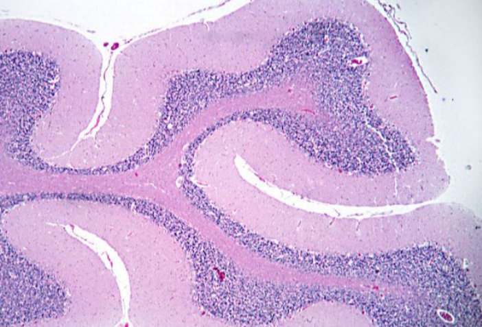 <p>Identify the CNS tissue shown:</p>