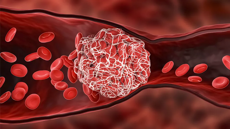 <ul><li><p>Venous thromboembolism</p></li><li><p>Stroke and myocardial infarction (especially in smokers over 35)</p></li><li><p>Increased risk of breast and cervical cancer</p></li></ul><p></p>