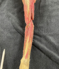 <p>Identify the muscle</p>