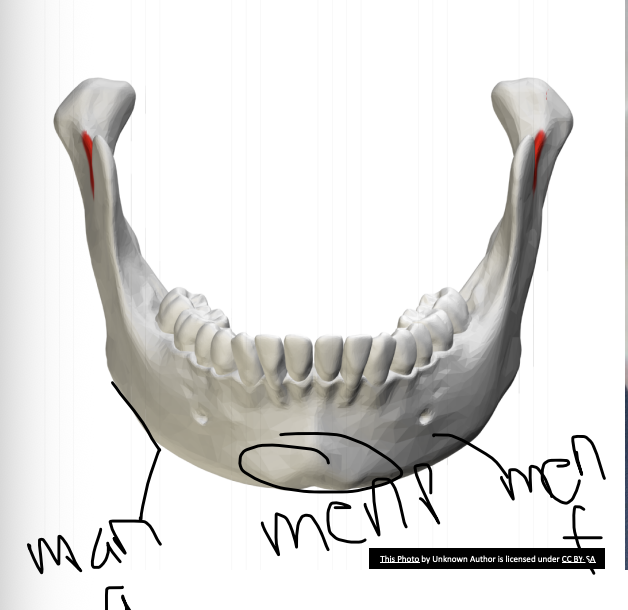 <p>mental foramen of the mandible</p>