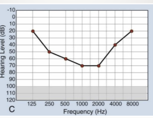 <p>what type of audiogram</p>