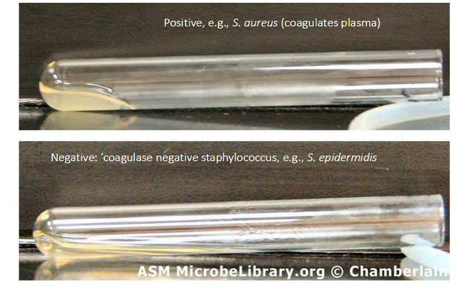 <p>- what we do is we get plasma (left from spinning blood to be left with plasma) and if we add Staph aureus culture to the plasma the coagulase enzyme which is present in Staph aureus coagulates the plasma and you get a little clot</p><p>- forms a little clot within and it activates the clotting cascadde in the plasma</p><p>.</p><p>- coagulase negative staphylococci shows that plasma spreads over the test tube</p>