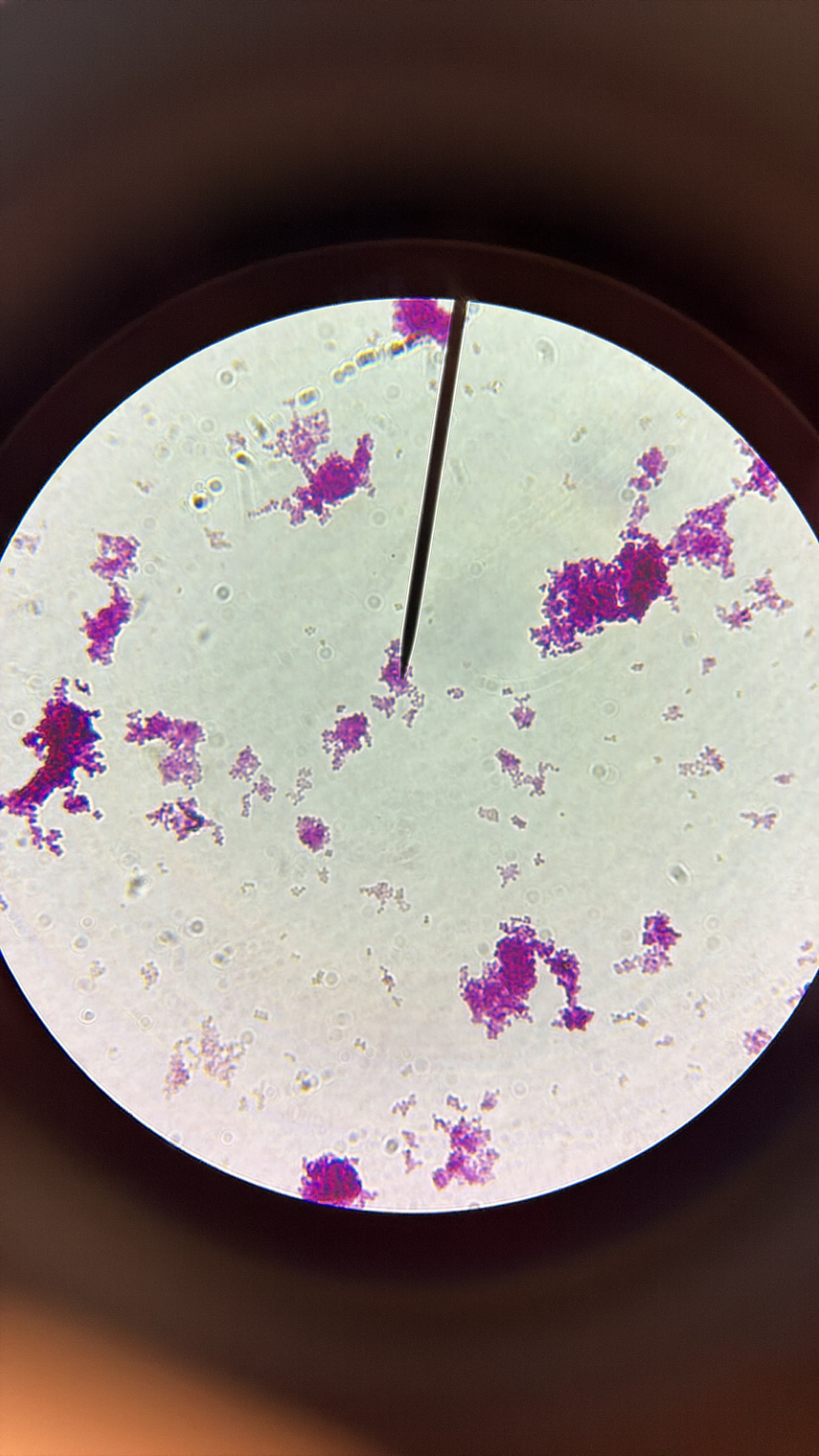 <ol><li><p>This slide shows a/an:</p></li></ol><p class="p1">a) Prokaryotic cell</p><p class="p1">b) Eukaryotic cell</p><p class="p1">c) None of the above</p><ol start="2"><li><p class="p1">Which type of cells does this slide show?</p><p class="p1">a) Cocci cells</p><p class="p1">b) Bacilli cells</p><p class="p1">c) Spirilli cells</p><p class="p1">d) None of the above</p></li></ol><ol start="3"><li><p class="p1">Which type of cell does this slide show an example of:</p></li></ol><p class="p1">a) Spirogyra</p><p class="p1">b) Volvox</p><p class="p1">c) Diatoms</p><p class="p1">d) None of the above</p><ol start="4"><li><p class="p1">Which type of cell does this slide show an example of:</p><p class="p1">a) Amoeba</p><p class="p1">b) Paramecium</p><p class="p1">c) None of the above</p></li><li><p class="p1">Which type of cell does this slide show an example of:</p><p class="p1">a) Archaebacteria or Eubacteria</p><p class="p1">b) Plantae</p><p class="p1">c) Protista</p><p class="p1">d) Fungi</p><p class="p1">e) Animalia</p></li></ol><p class="p1"></p><p class="p1"></p>