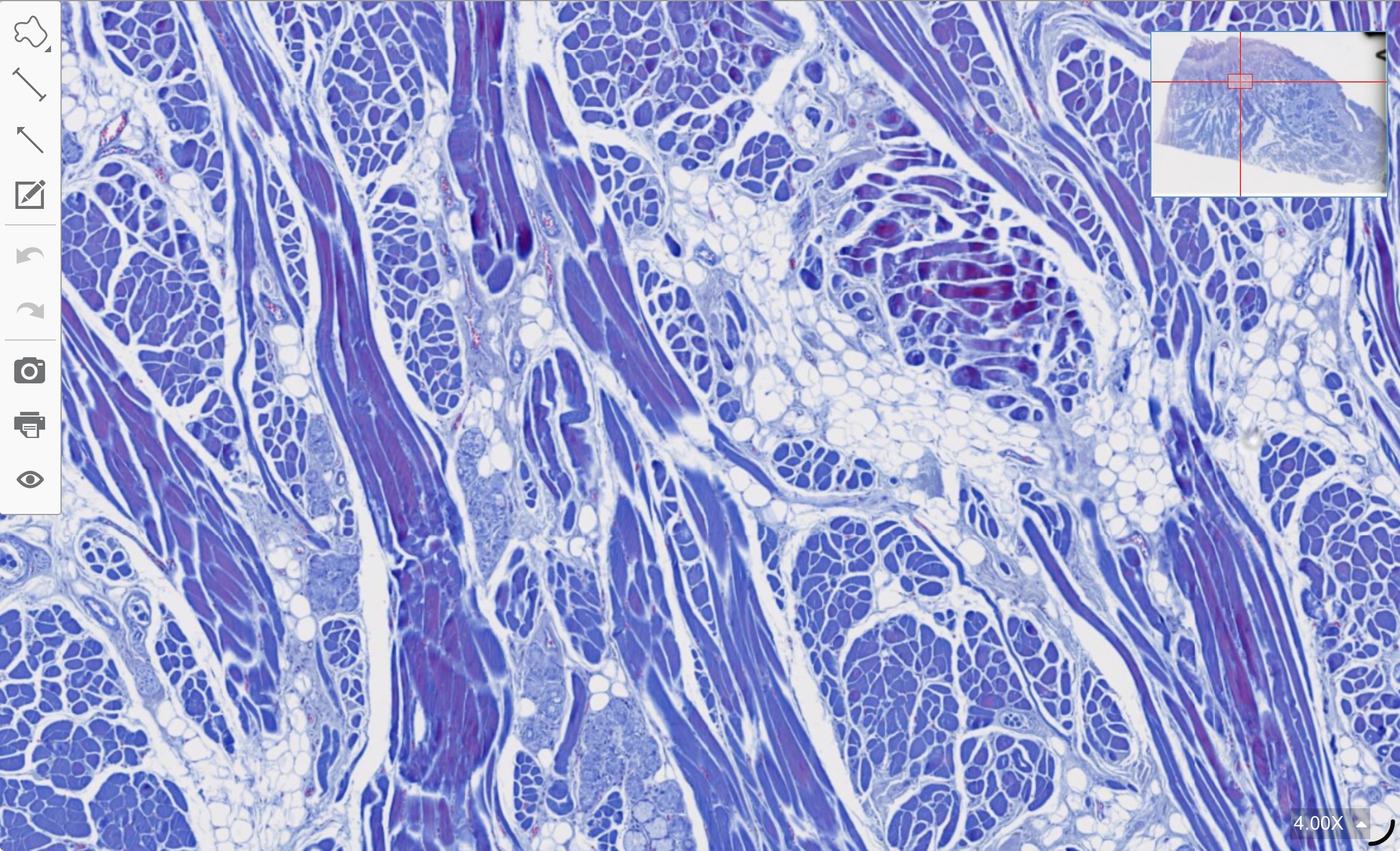 term image