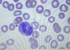 <p>Idenitity WBC?</p>