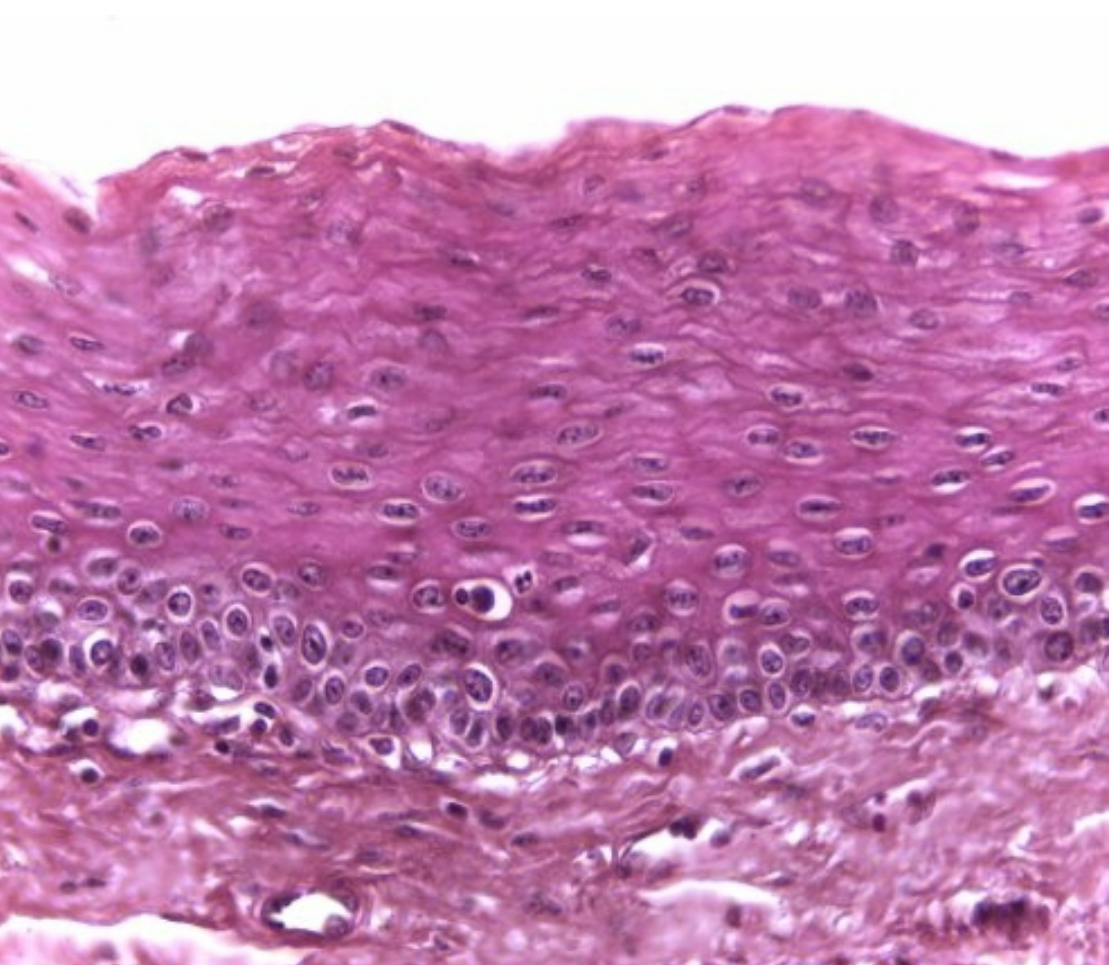 <p>Stratified Squamous Epithelium: Non-Keratinized</p>
