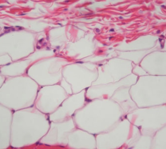 <p>Structure: closely packed adipocytes</p><p>Function: stores energy</p><p>Location: subcutaneous layer</p>