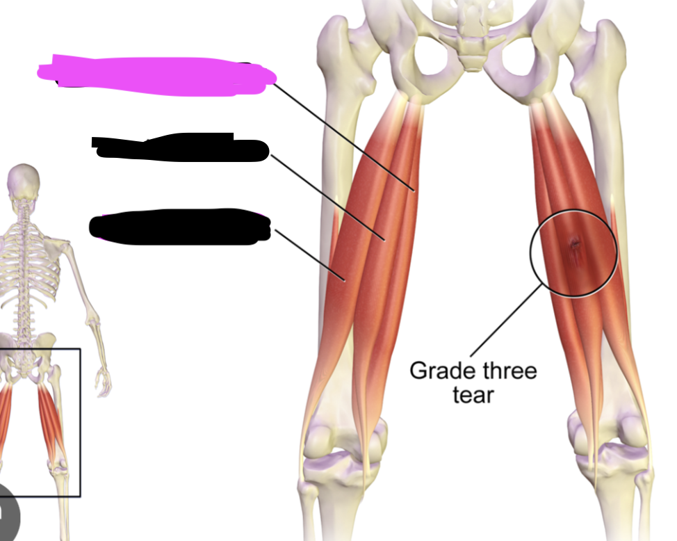 <p>Flex knee - extends hip, flexes knee</p>