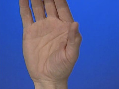<p>In this view of the right hand, identify the primary muscle responsible for this movement of the thumb.</p>