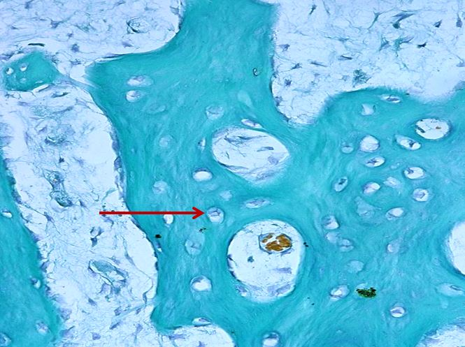 <p>Tế bào gì ?</p>