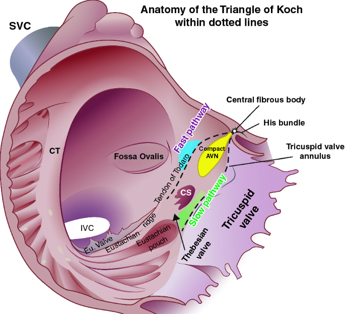 <p>Triangle of kock</p><ul><li><p>usually between cs and tricupsid leaflet </p></li></ul><p></p>