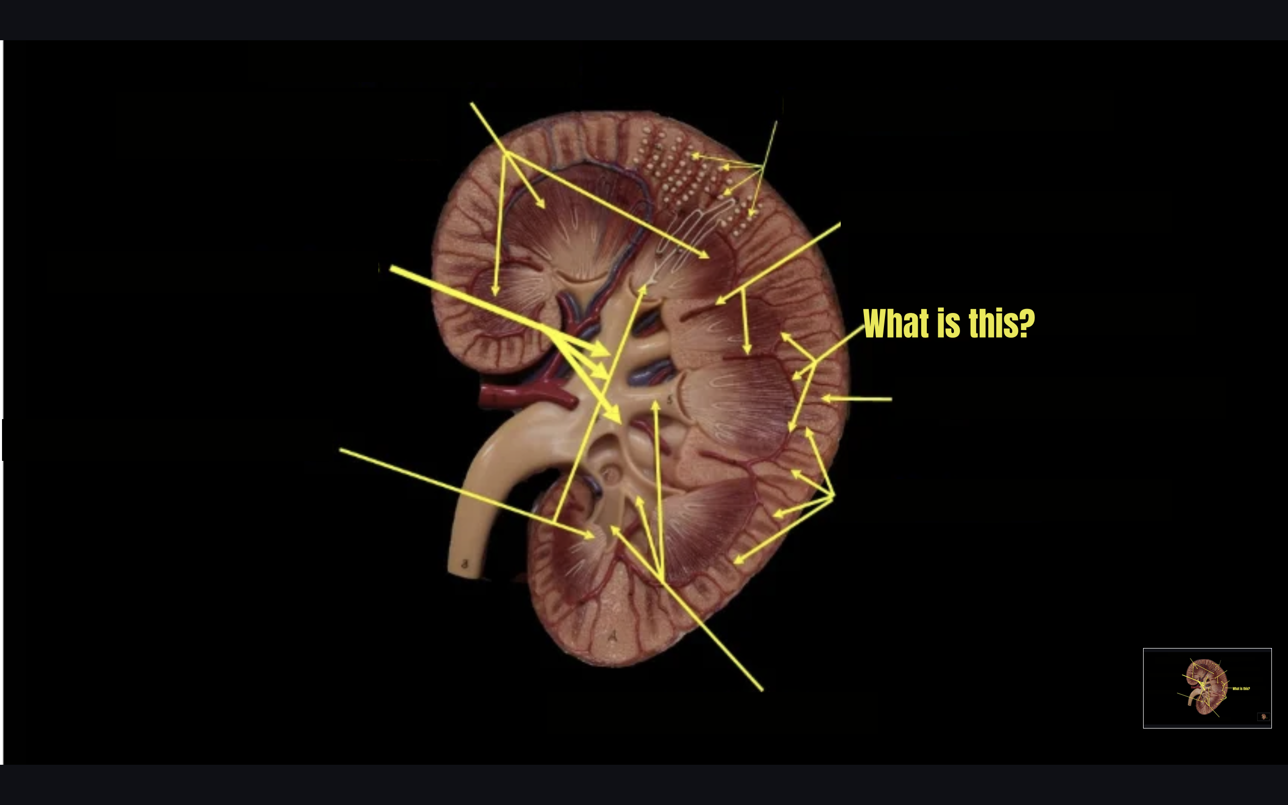 term image