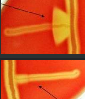 <p><span>You have identified a Gram positive streptoococci that is negative for catalase production, has a clear halo of hemolysis when grown on the SBA, and does not have a zone of inhibition around the Bacitracin disc when tested for susceptibility.&nbsp; What should the CAMP test look like to confirm that you have&nbsp;</span><em>Streptococcus agalactiae</em><span>&nbsp;according to the Dichotemous Key for the Identification of Gram positive bacteria (found in the Experiment PPT?)</span></p>