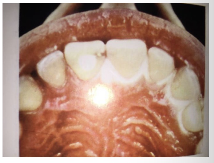 <p>CHẨN ĐOÁN </p>