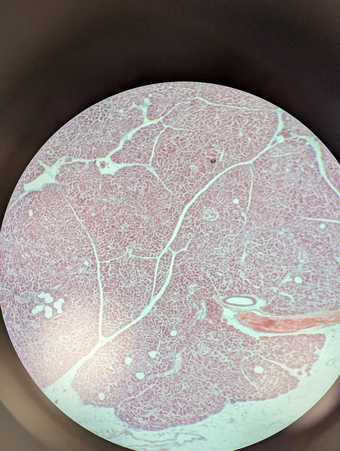 <p>Where in the body is this</p>