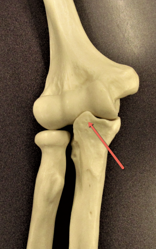<p><span><strong>Identify the bone marking indicated by the pointer.</strong></span></p>