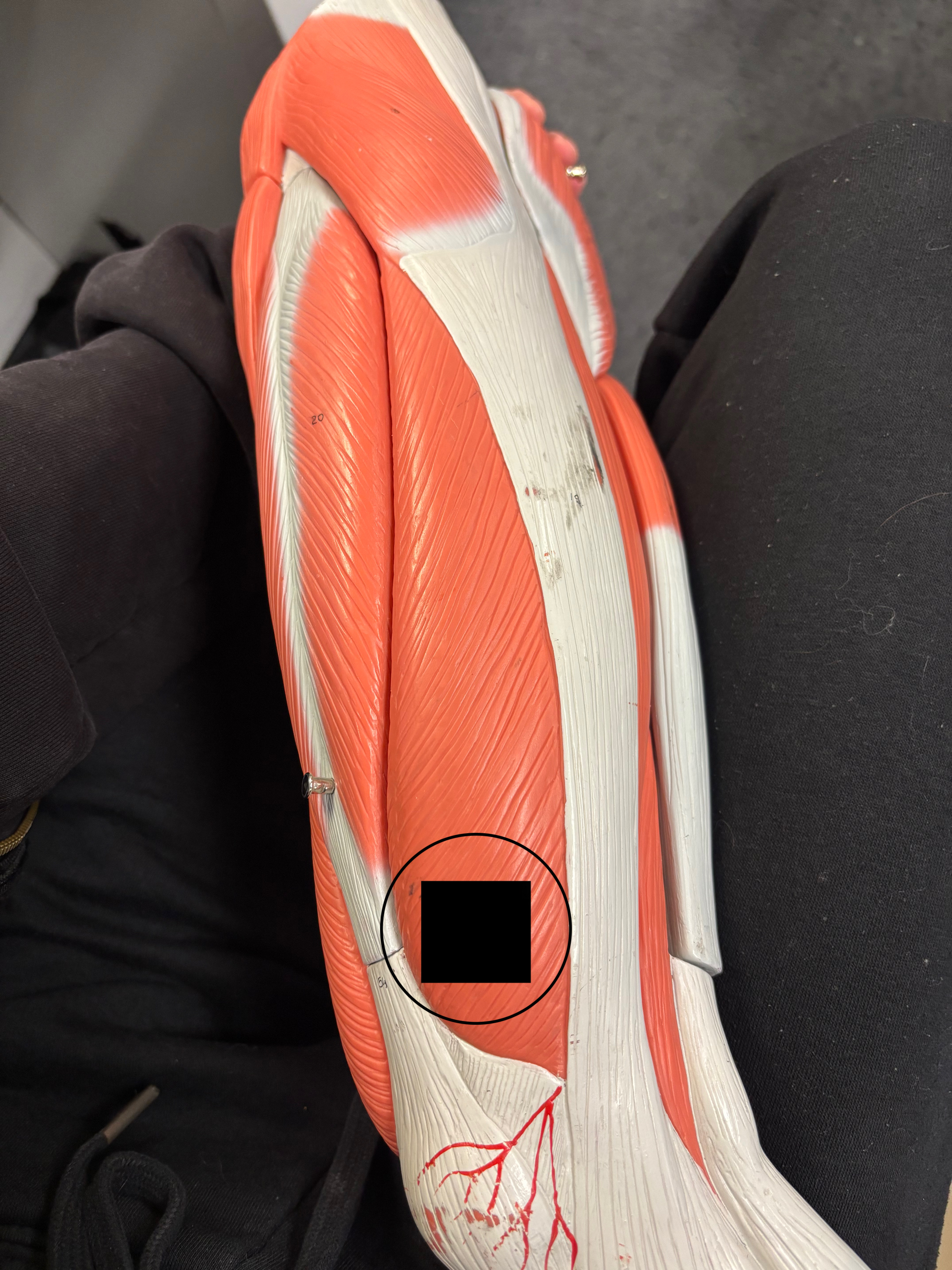 <p>What muscle is this and what is its action?</p>